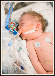 Edison's story, infant bereavement- a baby in the nicu
