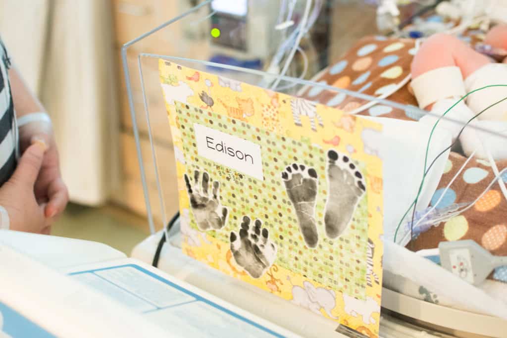 Infant bereavement, Edison's story -hands and feet