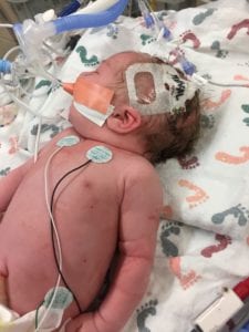 Edison's story; infant loss